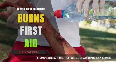 Electrical Burns: First Aid Treatment and Care