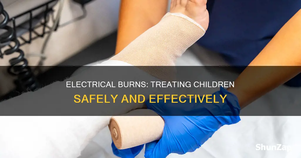 how to treat electrical burns for children