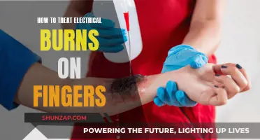 Electrical Burns: First Aid for Finger Injuries
