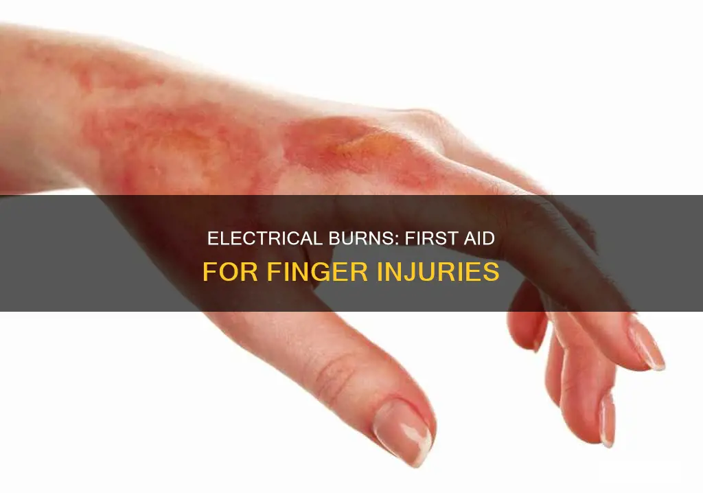how to treat electrical burns on fingers