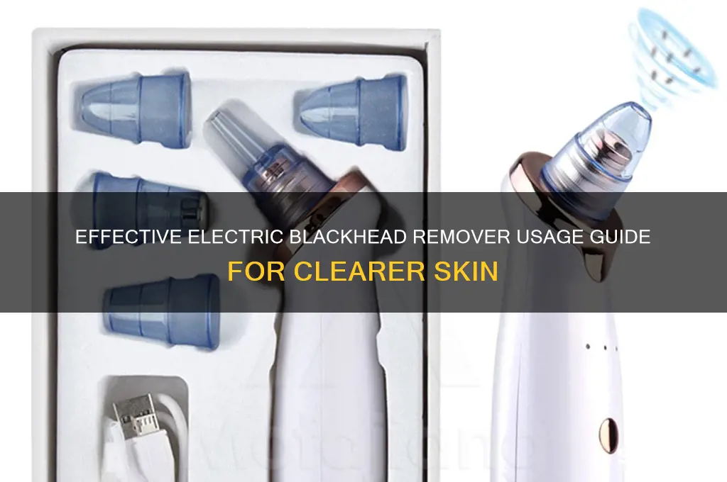 how to use a electric blackhead remover