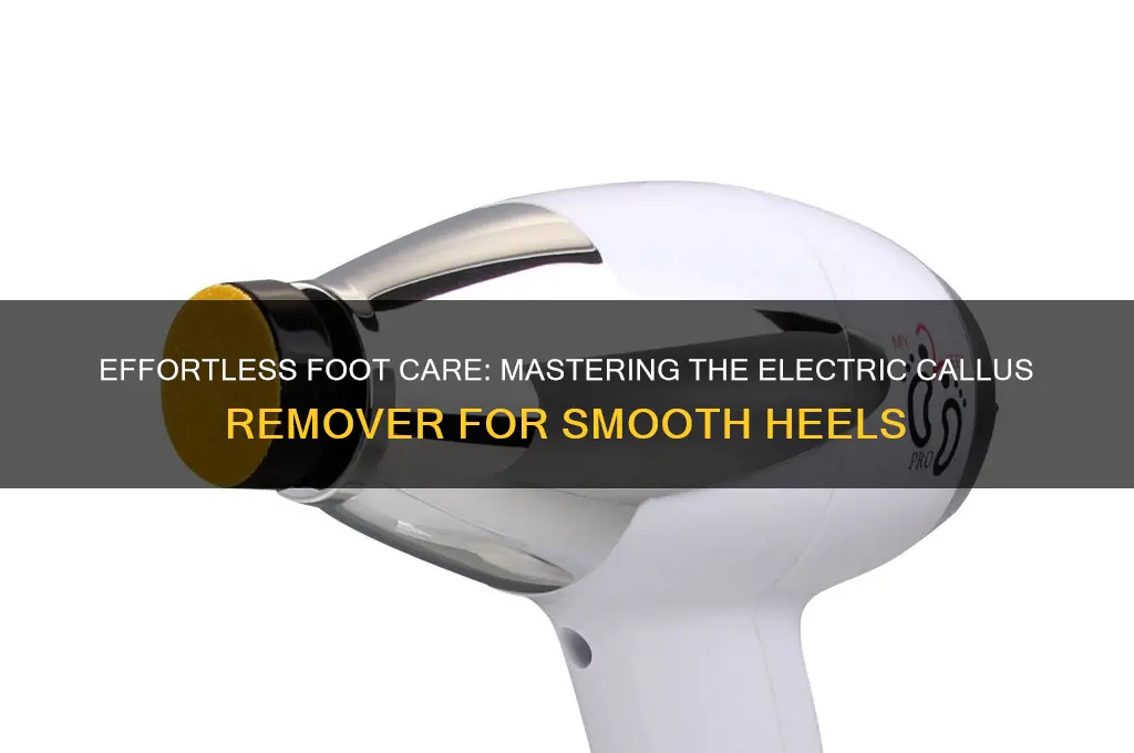 how to use an electric callus remover