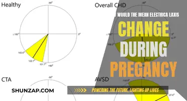 Electrical Axis Shift: Pregnancy's Effect on the Heart