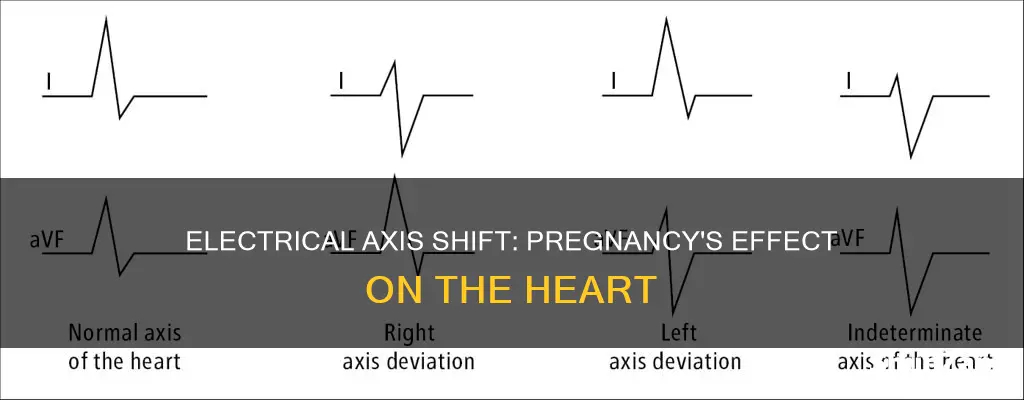 how would the mean electrica laxis change during pregancy