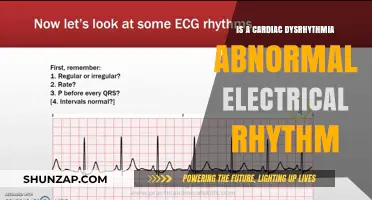 Electrical Rhythm Abnormalities: Cardiac Dysrhythmia Explained