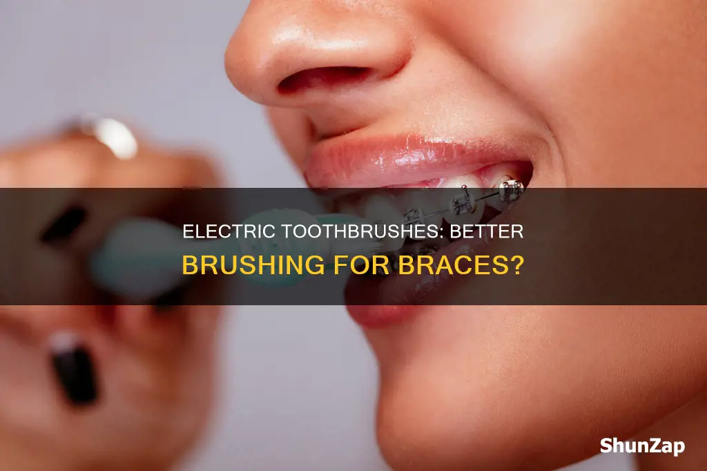 is an electric toothbrush better for braces