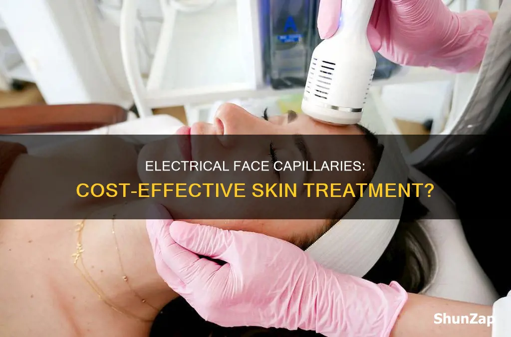 is electrical capillaries on the face inexpensive