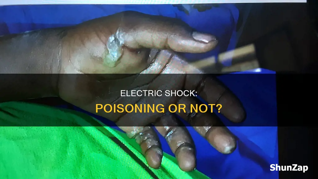 is electrical exposure a kind of poisoning