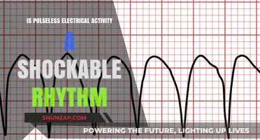 Electrical Activity Without a Pulse: Is It Shockable?