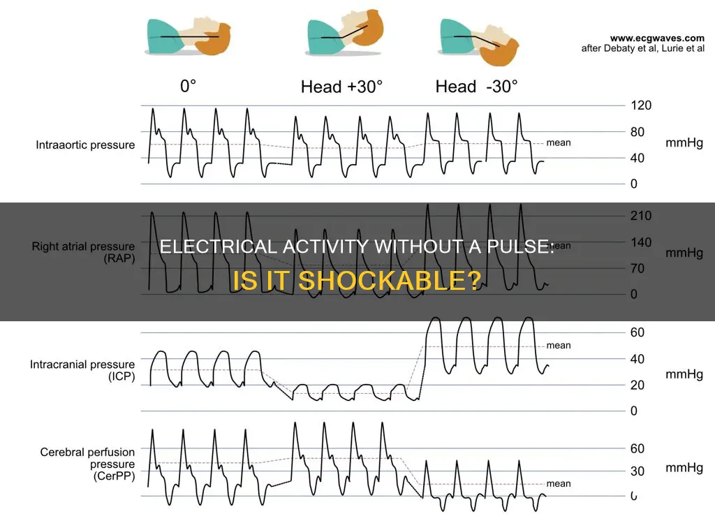 is pulseless electrical activity a shockable rhythm