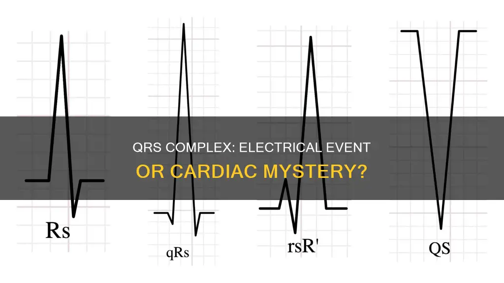 is the qrs complex an electrical event