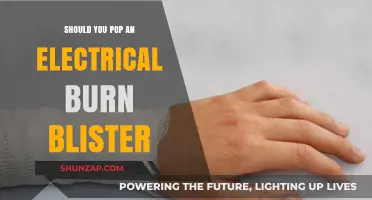 Electrical Burn Blisters: Pop or Not to Pop?