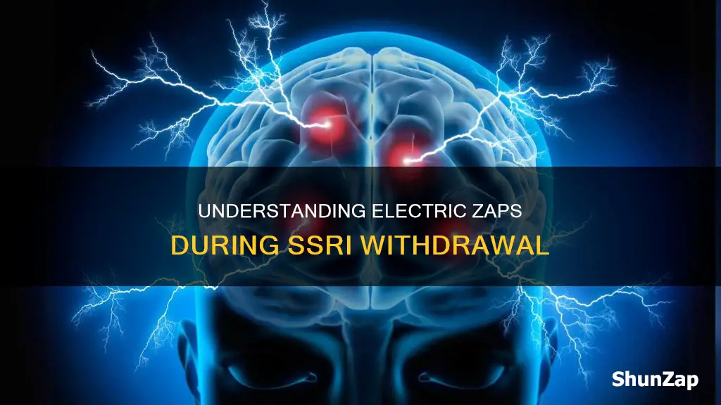 what are the electric zaps ssri withdrawal