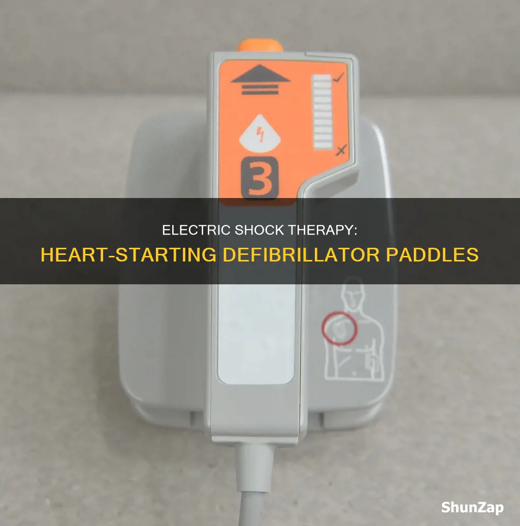 what are the heart electric paddles called