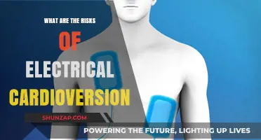 Cardioversion Risks: What You Need to Know