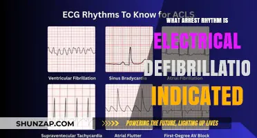 Defibrillation: When and Why Electrical Therapy is Necessary