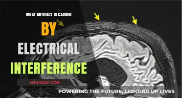 Electrical Interference: Artifacts and Their Impact