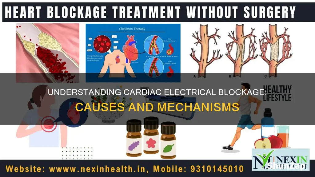 what causes blockage of cardiac electrical activity