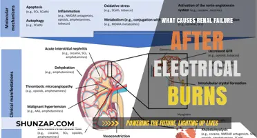 Electrical Burns: Kidney Failure Risk Factors