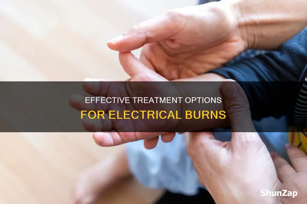 what do you put on electrical burns