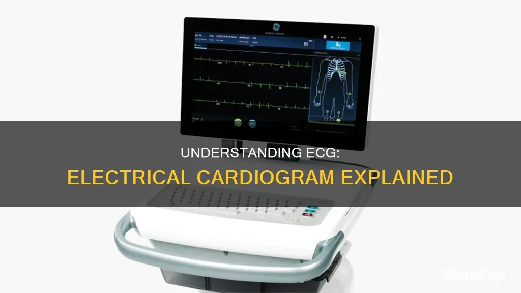 what doe ecg mean on electrical cardiogram