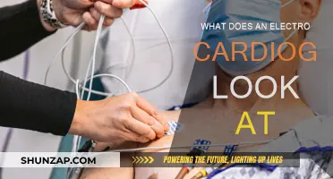 Electrocardiogram: Heart's Electrical Activity Visualized