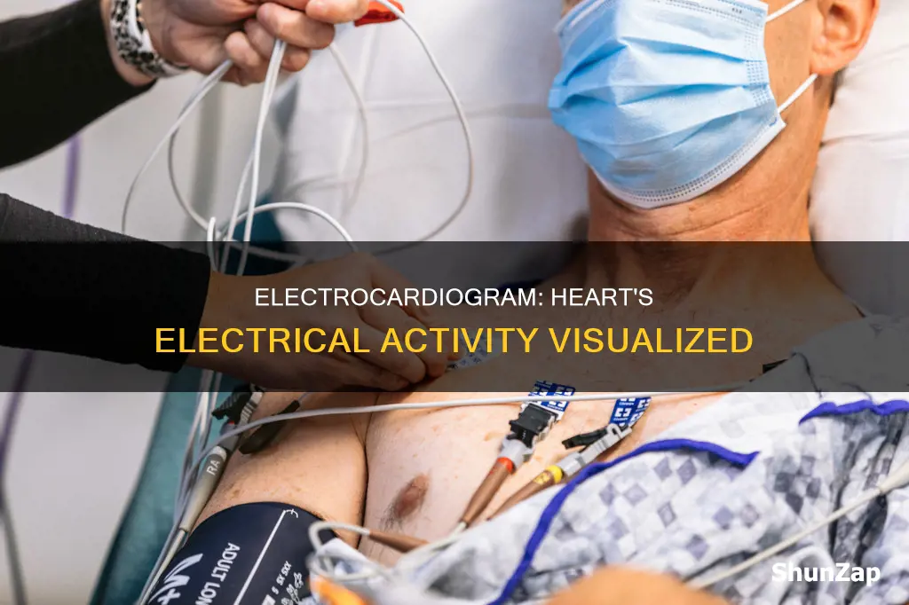 what does an electro cardiogram look at