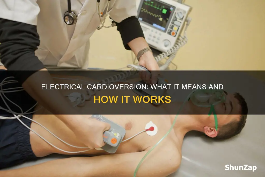 what does electrical cardioversion mean