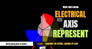 The Electrical Axis: What Does It Mean?