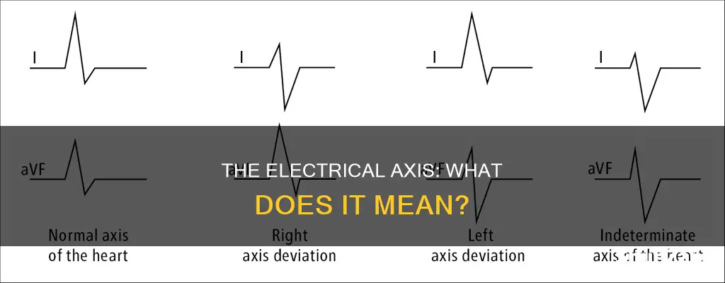what does mean electrical axis represent
