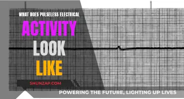 Understanding Pulseless Electrical Activity: A Medical Mystery