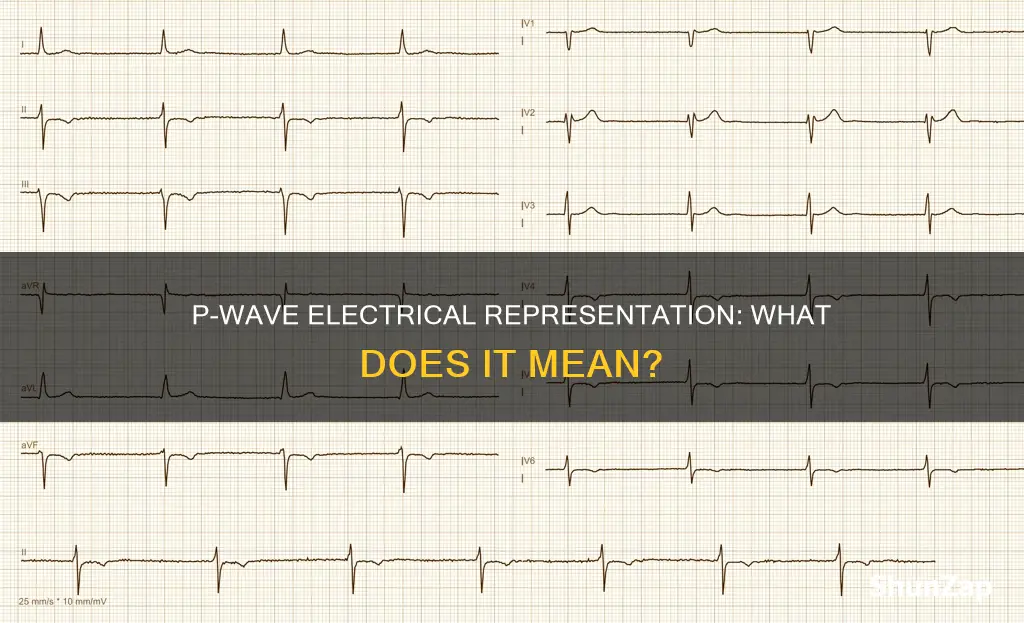what does the p wave represent electrically