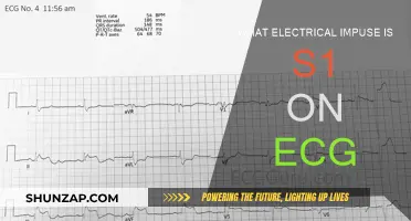 Understanding the Electrical Impulse of an ECG S1 Waveform