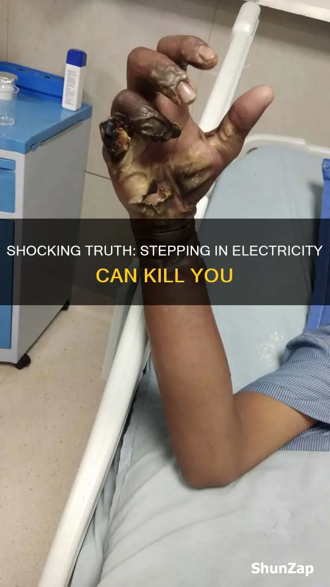 what happens if you step in electricity