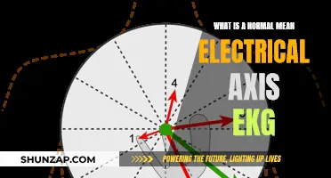 Understanding the Electrical Axis of a Heart