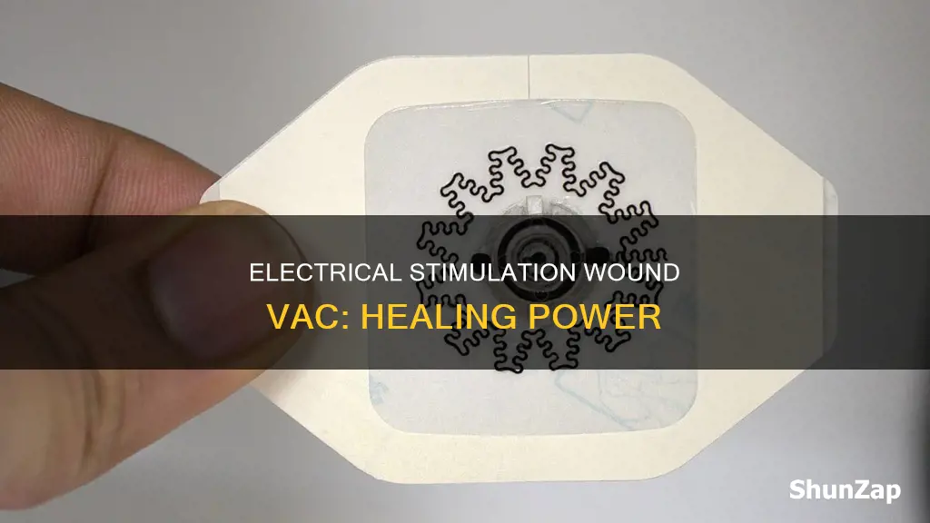 what is an electrical stimulation wound vac