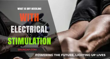 Dry Needling: Electric Stimulation for Pain Relief