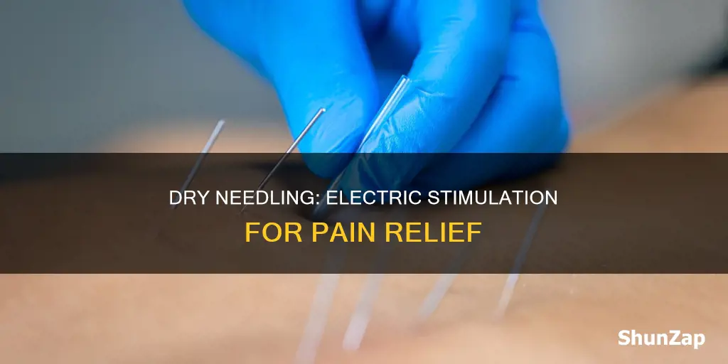 what is dry needling with electrical stimulation