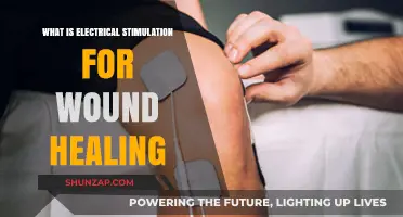 Electrical Stimulation Therapy: Healing Wounds Faster