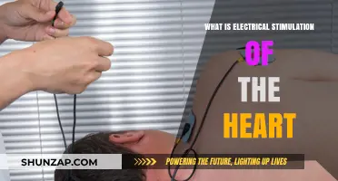 Electrical Heart Stimulation: How Does It Work?