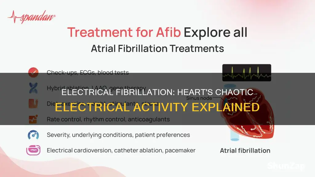 what is fibrillation of the heart electrical