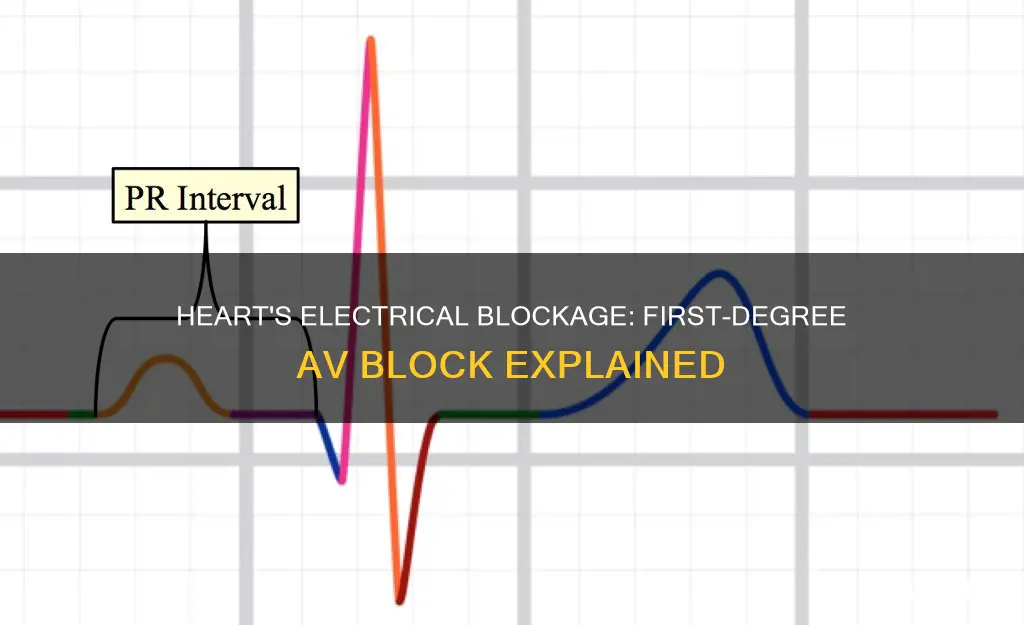 what is first degree heart blockage electrical