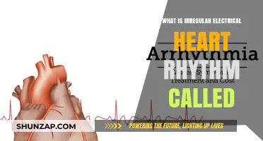 Electrical Heart Rhythm: What's the Irregularity Called?