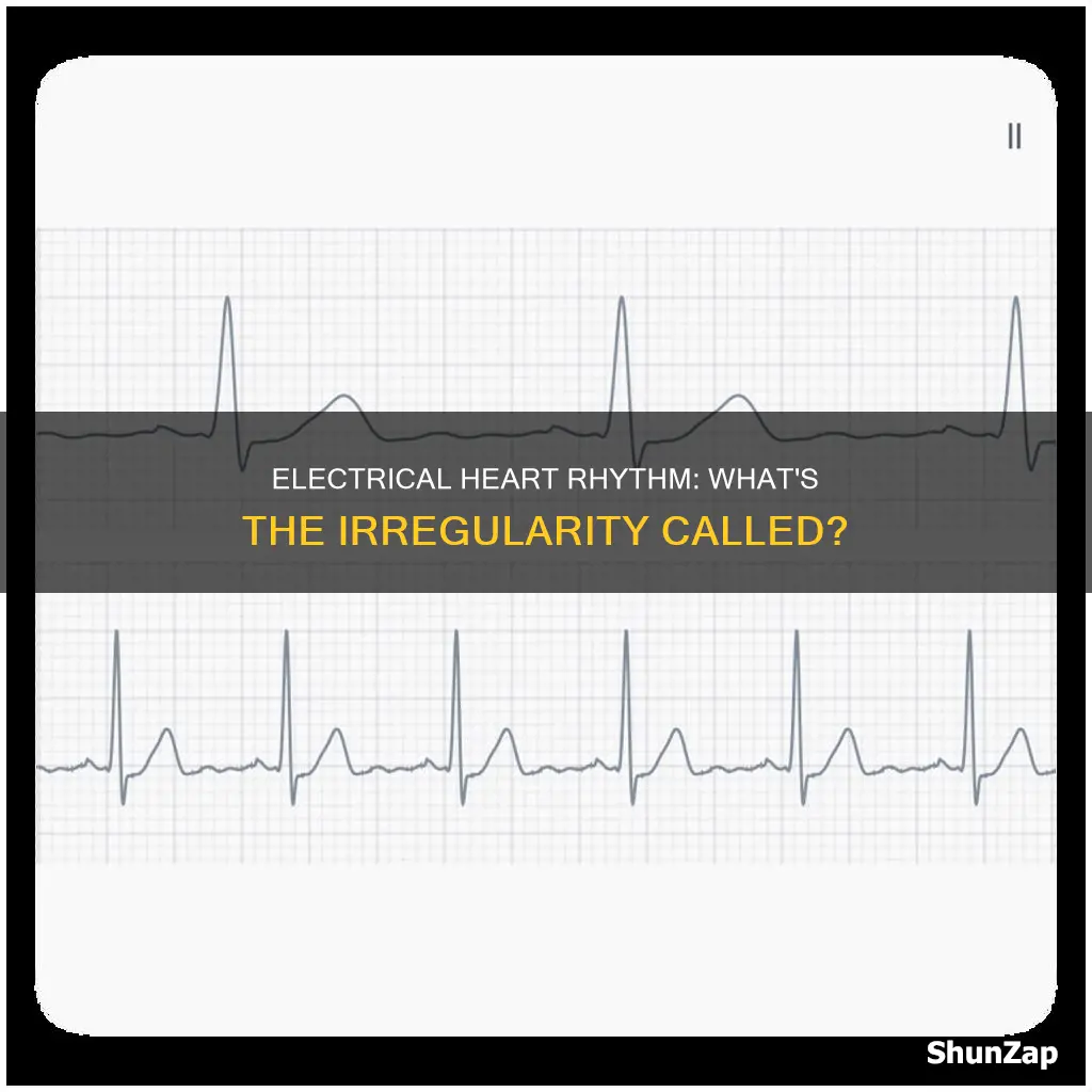 what is irregular electrical heart rhythm called
