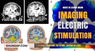 Brain Imaging: Electric Stimulation and Lesion Effects