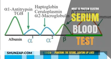 Protein Electro Serum Blood Test: What, Why, and How?