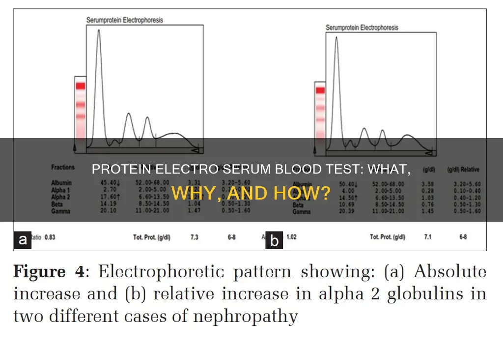 what is protein electro serum blood test