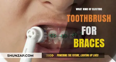 Electric Toothbrushes: Best Types for Braces