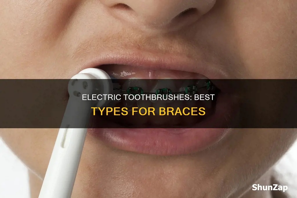 what kind of electric toothbrush for braces