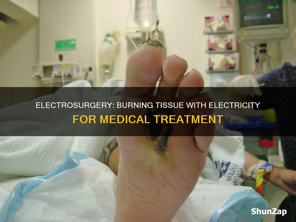 what medical term means electrical burning of tissue